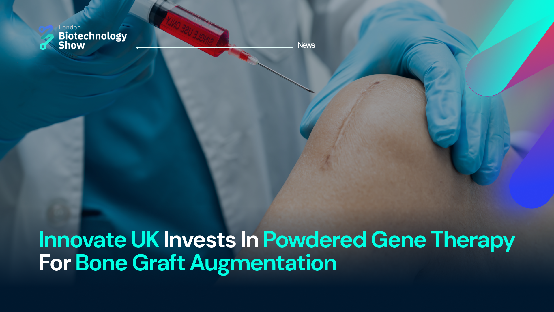 Innovate UK Invests In Powdered Gene Therapy For Bone Graft Augmentation
