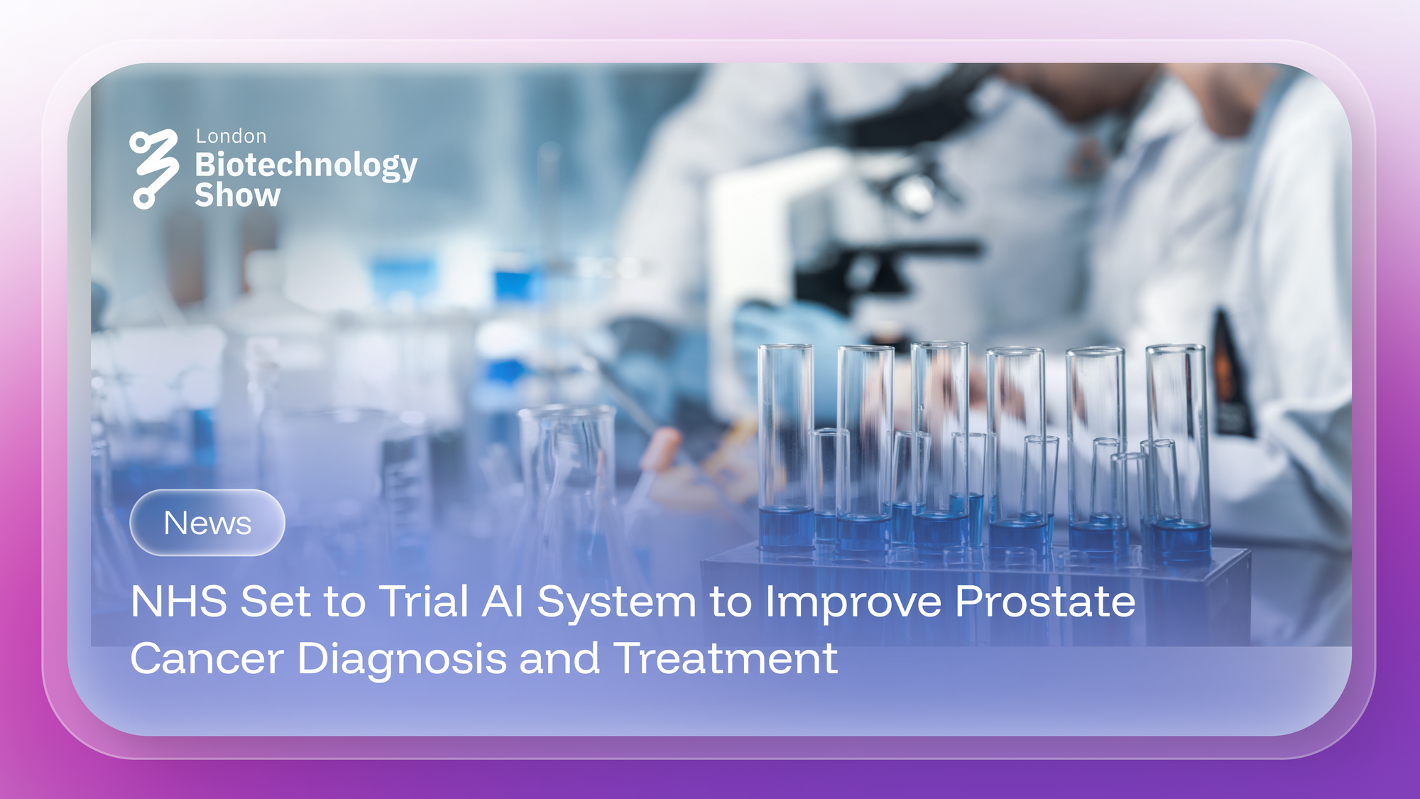 NHS Set to Trial AI System to Improve Prostate Cancer Diagnosis and Treatment