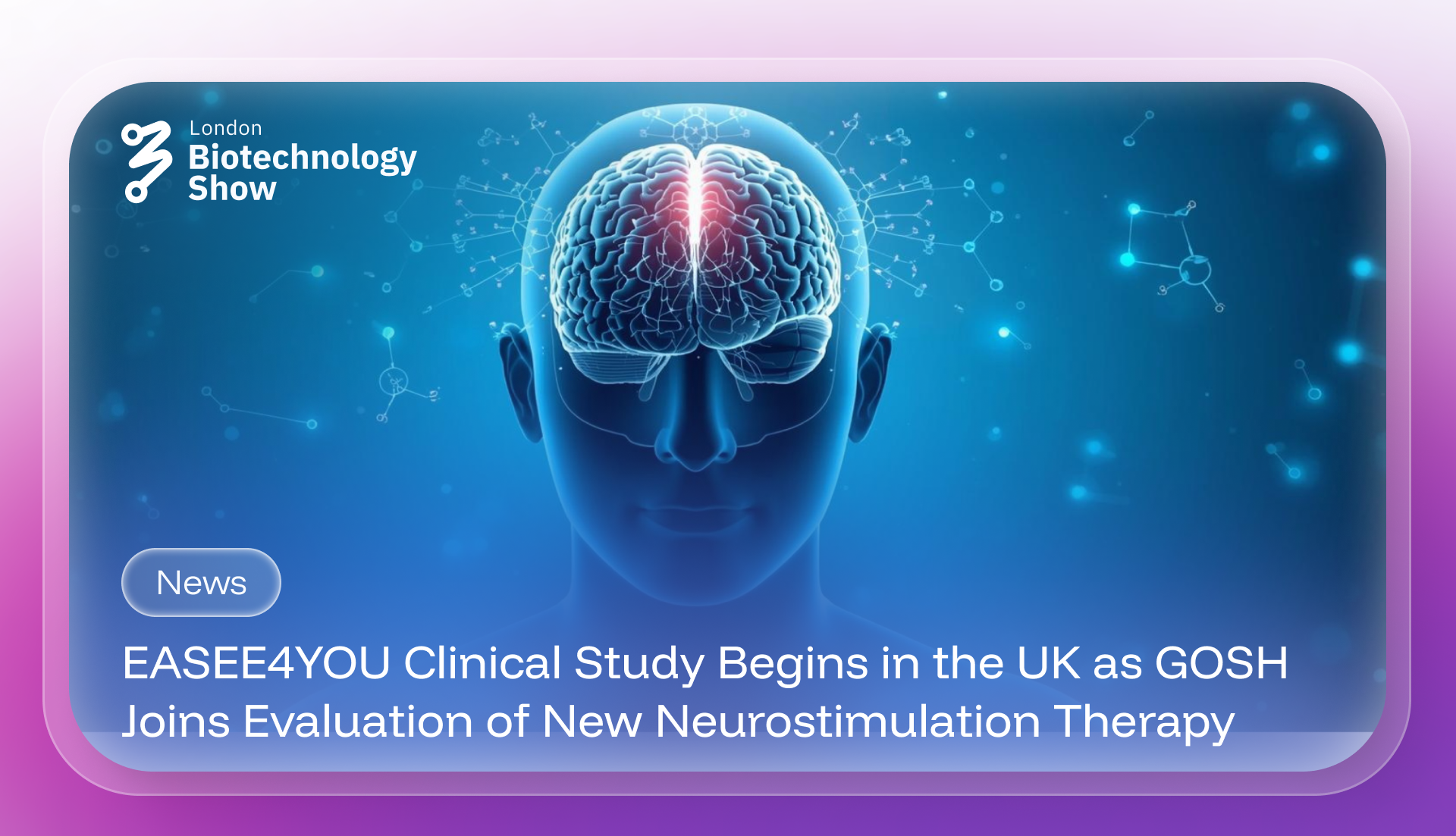 EASEE4YOU Clinical Study Begins in the UK as GOSH Joins Evaluation of New Neurostimulation Therapy